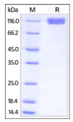 Human CD117, Fc Tag on SDS-PAGE under reducing (R) condition. The gel was stained overnight with Coomassie Blue. The purity of the protein is greater than 95%.